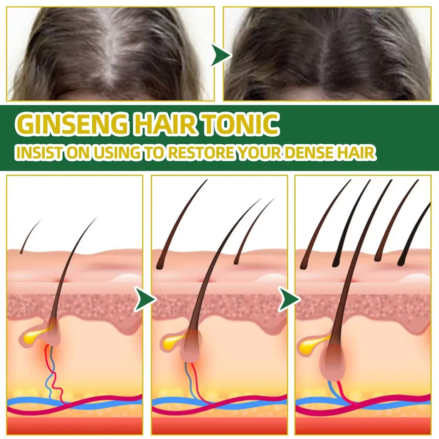 OUHOE® Spray Crecimiento del Cabello con Jengibre y Ginseng Coreano – Fortalece, Engrosa y Da Brillo
